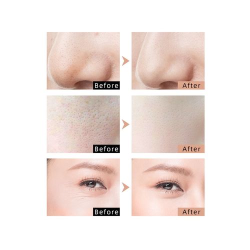 LED Skin Spectrum Rejuvenation Mask - NEW