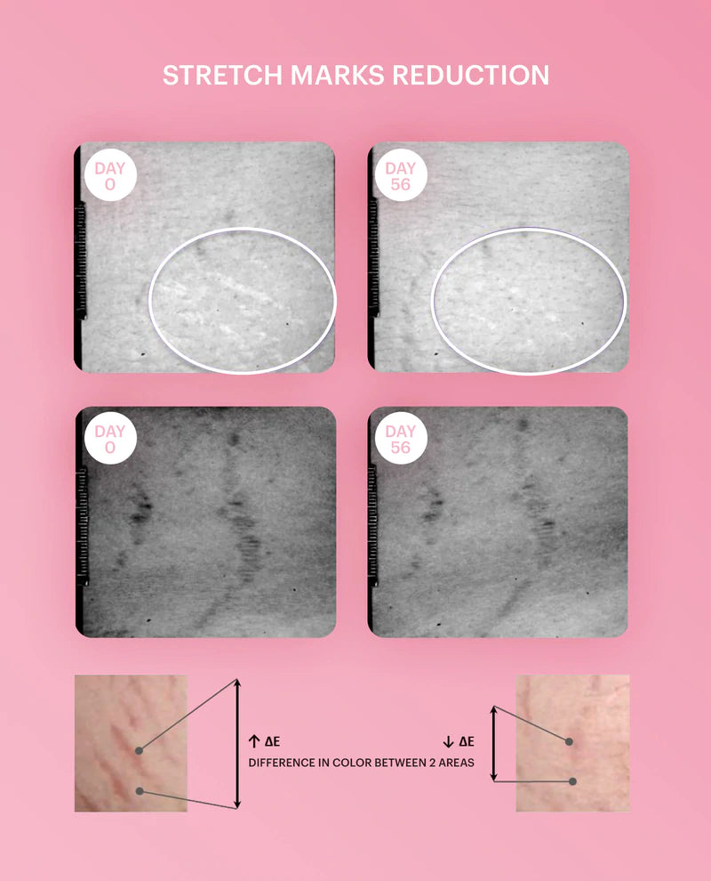 Firming Breast Lotion